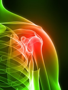 Inflammation
